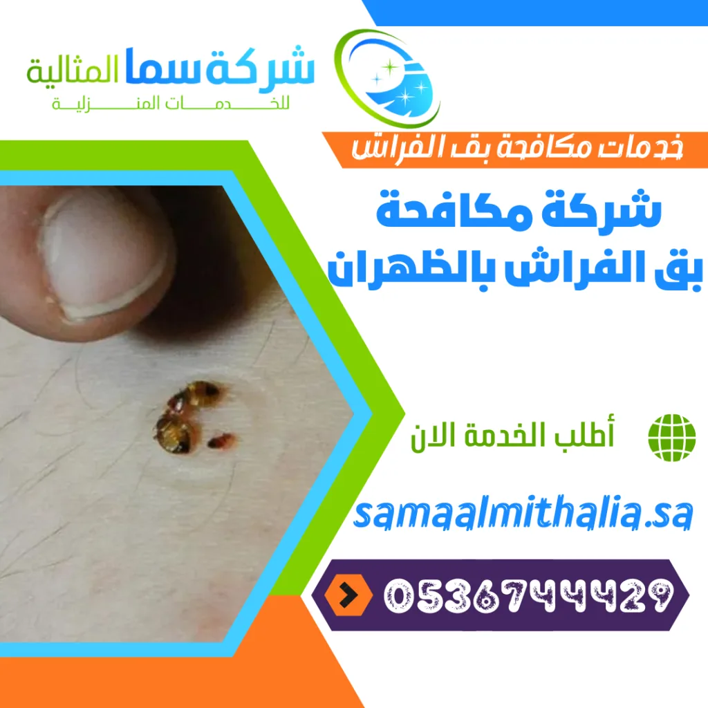 شركة مكافحة بق الفراش بالظهران